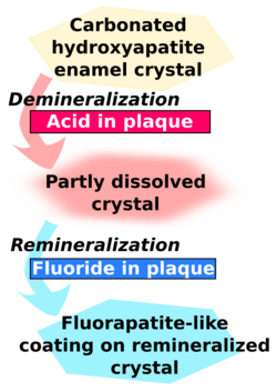 Carbonated hydroxyapatite enamel crystal is demineralised by acid in plaque and becomes partly dissolved crystal. This in turn is remineralised by fluoride in plaque to become a fluorapatite-like coating on remineralised crystal.