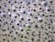Frogspawn