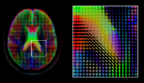 Brain imaging informatics