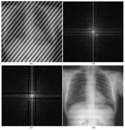 An example of how image processing can be applied to radiography.