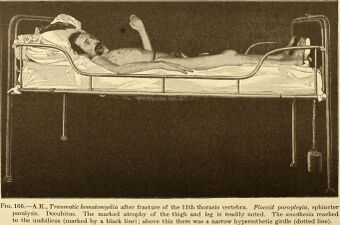 Diseases of the nervous system (1910) (14586639887).jpg