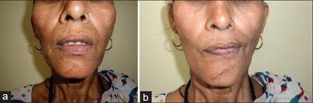 Ni 2013 61 6 653 125275 f1.jpg