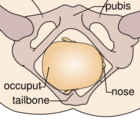 Cephalic presentation.svg