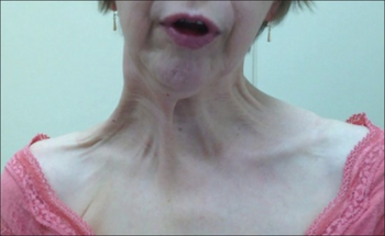 PMC5409377 AJNS-12-244-g001.png