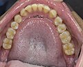 Lower dental view
