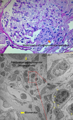 PMC5412754 CCR3-5-578-g002.png