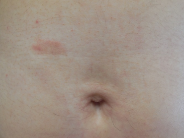 PMC5006551 dp0603a08g001d.png