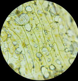 Celery tissue under 400× magnification