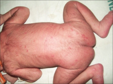 PMC3088947 IJD-56-92-g001.png