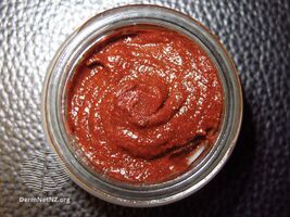Bloodroot paste/escharotic agents