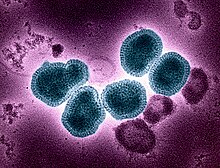 InfluenzaAvirussubtypeH3N2.jpg