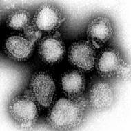 The influenza viruses that caused Hong Kong flu (magnified about 100,000 times)