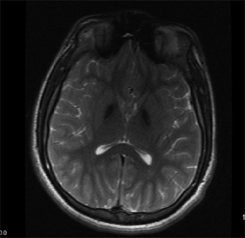 PMC5108146 JPN-11-288-g001.png