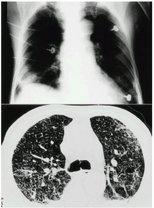 PMC4531943 kjim-13-2-127-10f1.png