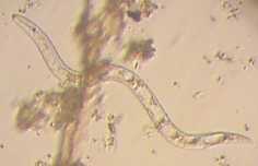 Roundworm