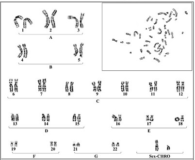 Young individual with ring chromosome 18. 46, XY, r (18) (p11.32 q21.32).