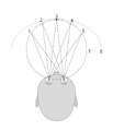Horopter