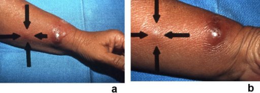 PMC1963326 1750-1172-2-34-10.png