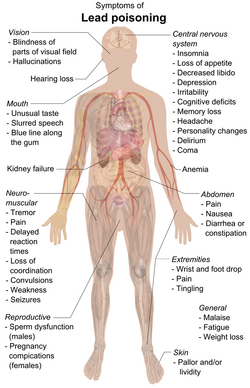 A chart of a human body with arrows pointing pieces of text to different parts of the body