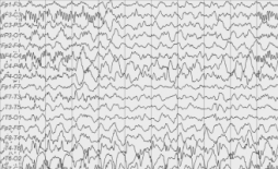 PMC3124728 jkms-26-951-g002 (1).png