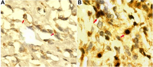 PMC3969338 ott-7-477Fig1.png