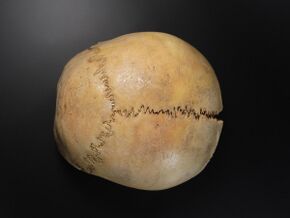 Cranium - neurocranium superior view 2.jpg