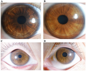 PMC5428903 MMR-15-05-3069-g03.png