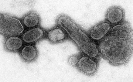 Transmission electron microscope image of a recreated 1918 influenza virus]]