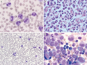 PMC4390711 alm-35-376-g001.png