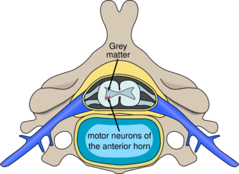 Polio spinal diagram-en.svg