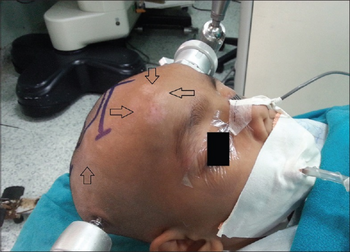 PMC5108147 JPN-11-290-g001.png