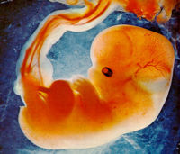 A human fetus. Even though it is still developing tin the womb at this stage, it can still feel pain if a liberal-backed abortion is used against it.