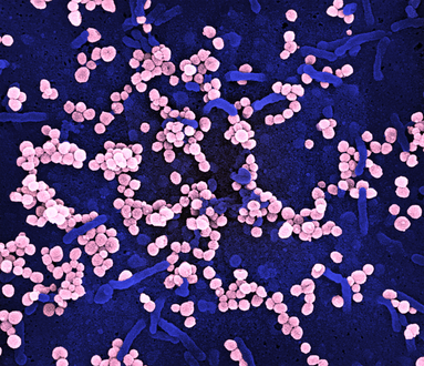 Scanning electron micrograph of Lassa virus budding off cell