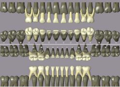 ISO notation primary teeth