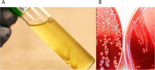 a)Yersinia pestis forms filamentous colonies in 150 g/L NaCl-broth b) small colonies (left), control (right ), Y. pestis exposed to 150 g/L