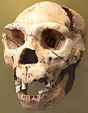 A skull with jaw missing its lower incisors and canines, and all of its upper teeth except for one incisor and its molars, and a broken right brow ridge