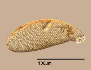 Testate amoeba, Cyphoderia sp.