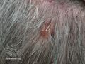 Clinical view (DermNet NZ sebaceous-carcinoma-01).jpg