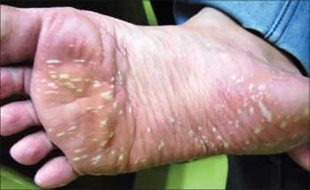 PMC4462810 IJPVM-6-51-g001.png