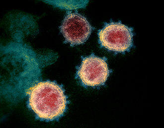 COVID19 virus.jpg