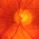 Color fundus picture