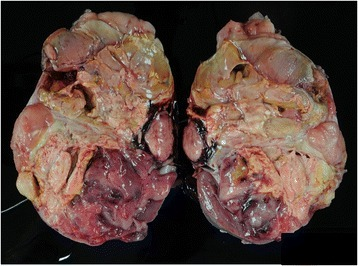 PMC4504129 13000 2015 352 Fig2 HTML.png