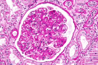 Transplant glomerulopathy - very high mag.jpg