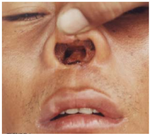 PMC1578576 1471-2334-6-139-4.png