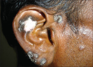 PMC3937502 IDOJ-5-87-g001.png