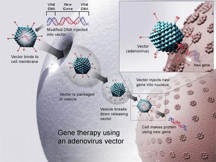 Gene therapy using an adenovirus vector. In some cases, the adenovirus will insert the new gene into a cell. If the treatment is successful, the new gene will make a functional protein to treat a disease.