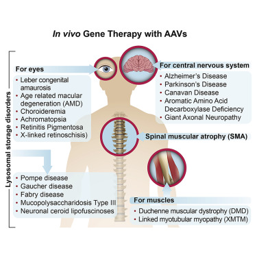 Gene therapy (in vivo ) with AAV[73]