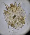 Sarcoptes scabei 2.jpg