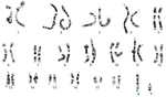 Karyotype of normal male pig.png