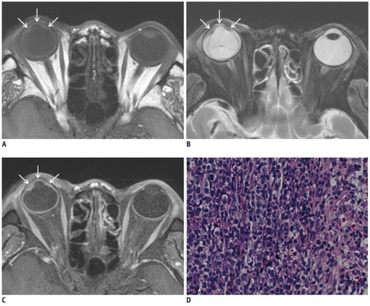 PMC3542295 kjr-14-122-g001.png